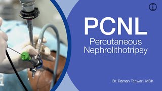 PCNL - Percutaneous Nephrolithotripsy | दूरबीन से गुर्दे की पथरी का विश्वसनीय इलाज