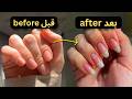 تطويل الاظافر بسررررعة في 3 ايام l قصتي مع اظافري القصيرة