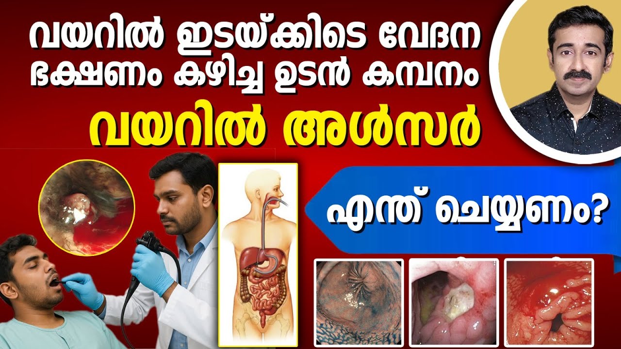 ദഹനക്കേട്. ഗ്യാസ്.. വയറിൽ അൾസർ.. മാറിയാലും വീണ്ടും വരുന്നു. ഇനി എന്ത് ചെയ്യണം ?