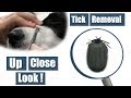 Dog Tick Removal