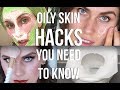 11 OILY SKIN HACKS (YOU NEED TO KNOW!)