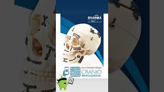 Sharma Orthopedic - Cranio Maxillo Facial Implants