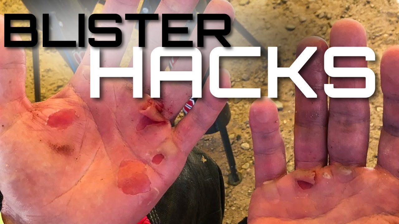 How To Ride With And Take Care Of Blisters Prevention YouTube