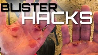 How To Ride With And Take Care Of Blisters | Prevention screenshot 5