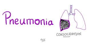 Pneumonia