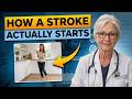 What a Stroke Looks Like the Day Before It Hits — Know This to Protect Yourself