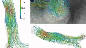 Simulation of blood inside an aneurysm