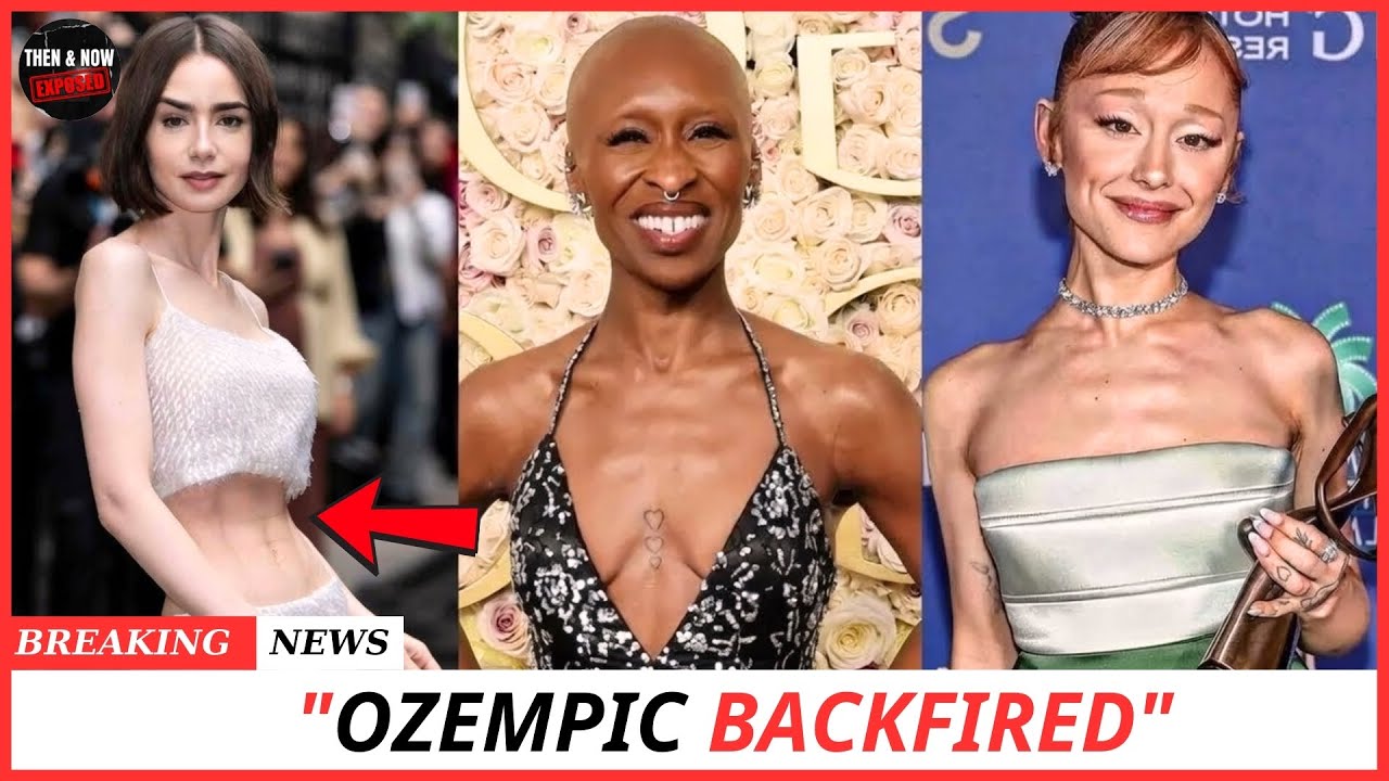 TOP 10 Celebrity Ozempic Transformations That Backfired - Badly | Then and Now 2026