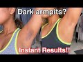 How To Get Rid Of Dark Armpits INSTANTLY! 100% works