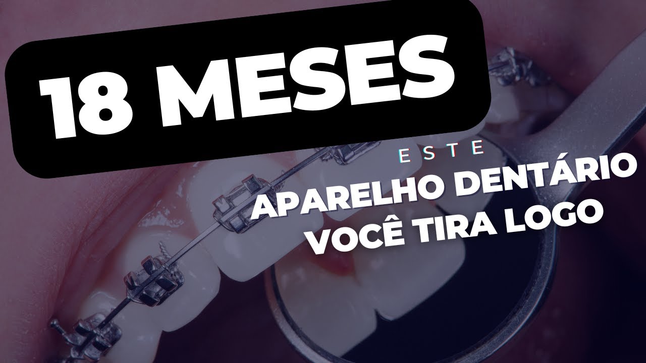 APARELHO AUTOLIGADO: RESULTADOS INCRÍVEIS EM APENAS 3 MESES! É POSSÍVEL?