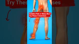 Sciatica Pain Or Sleep Disc ? Try These 4 Exercises 👌🏻|#yoga #sciatica #backpain #viral #viralvideo