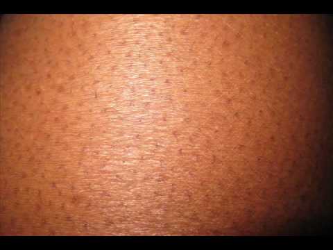 red spots on the skin - WebMD Answers