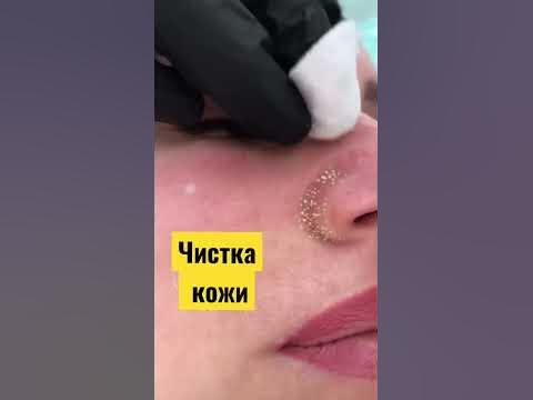 Чёрные точки - YouTube