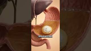 part 2: 🥚 Eating Boiled Egg on Empty Stomach — Safe or Risky?🤔Morning Health Benefits & Side Effects