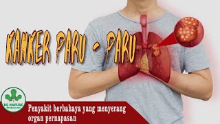 Detopar pipeca Herbal Obat TBC Paru Paru Basah, Infeksi Paru Tuberkulosis Original Herbal De Nature
