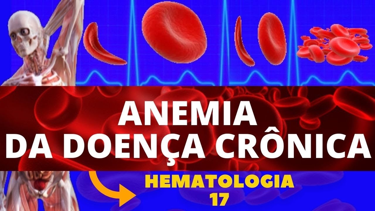 Anemia De Doença Cronica Ensino