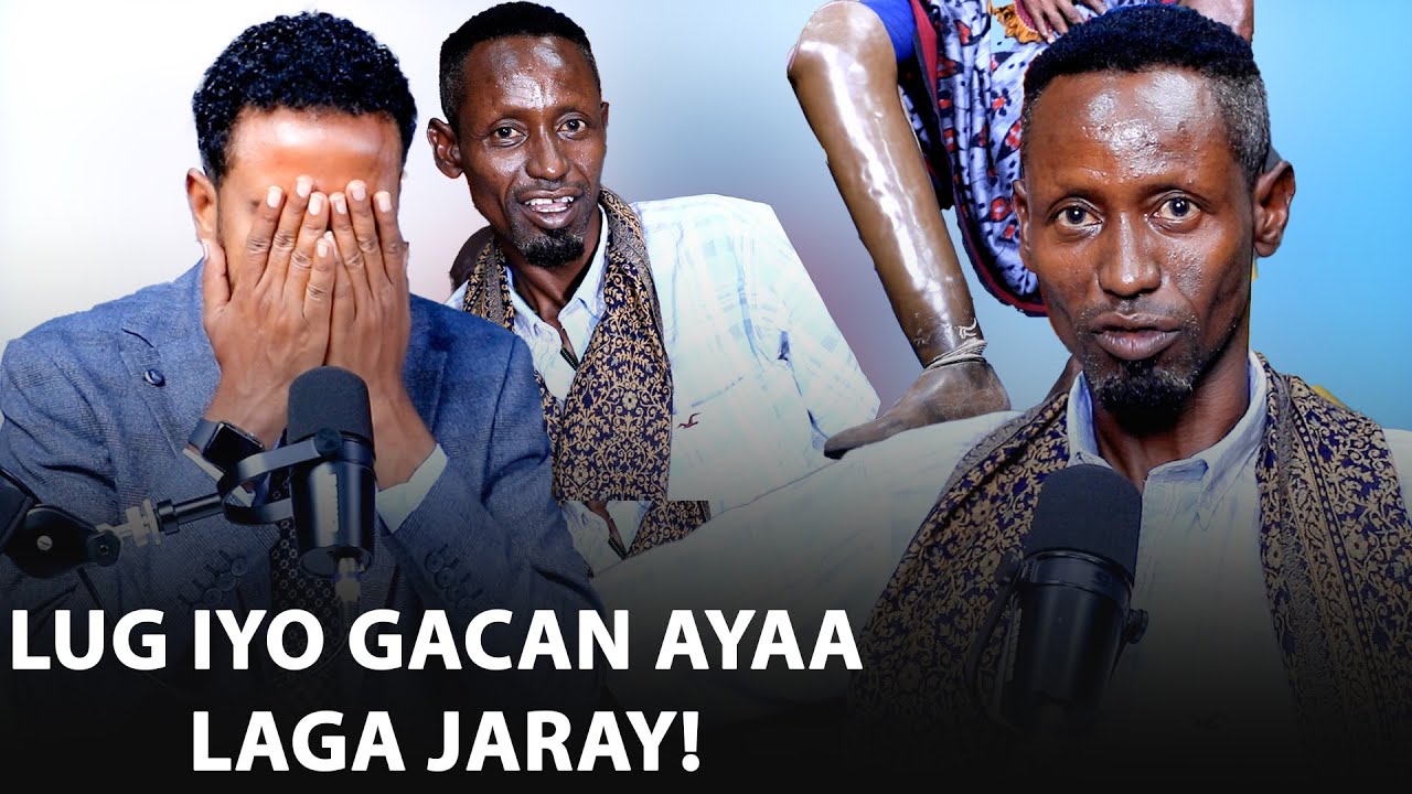 Hantidii oo laga dhacay rasaas lagu dhuftay lug iyo gacan laga jaray iyo Isbitaalkii waxa uu kala ku