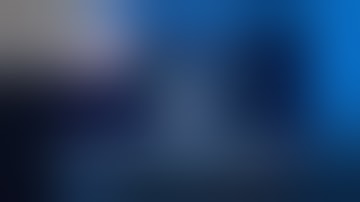 Episode 12 Part 1: Giant Anterior Communicating Artery Aneurysm with A3-A3 Bypass