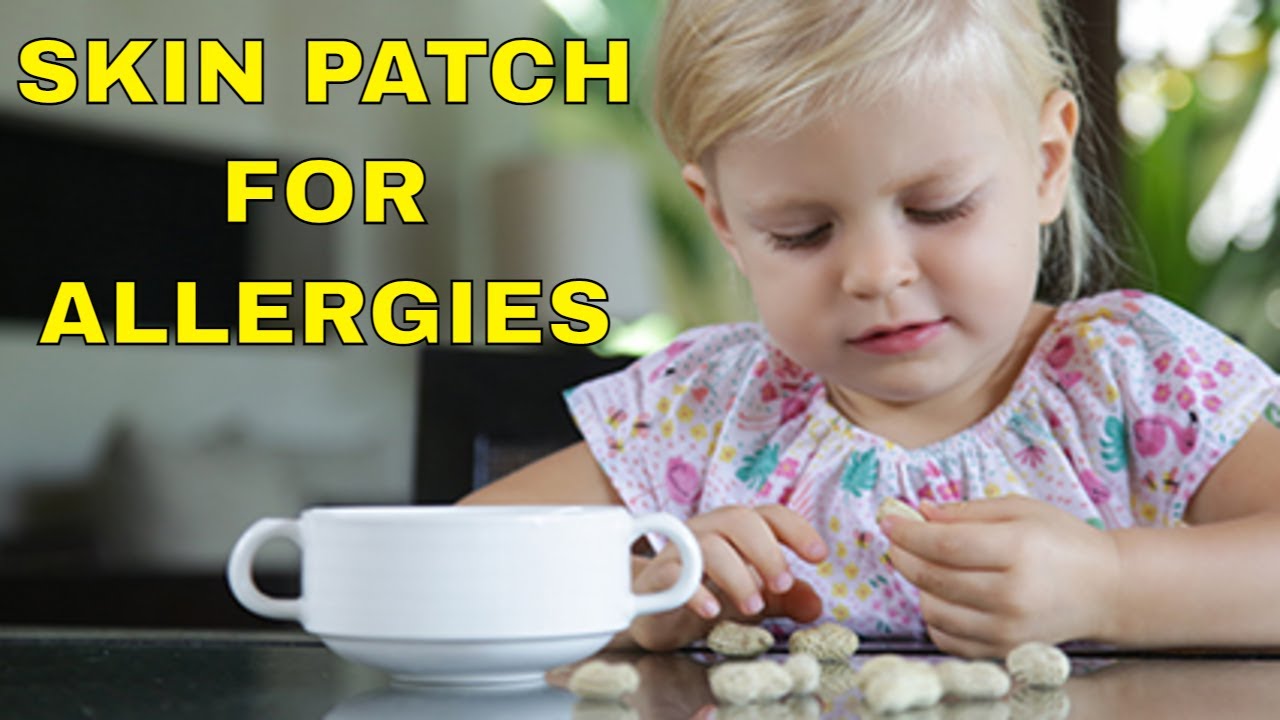 Immunotherapy Skin Patch Can Help Treat Toddlers with Peanut Allergy