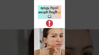 කුරුලෑ වදයෙන් බේරෙන්න හොදම විසදුම් #shorts #viral #beautytips #sinhala #healthtips