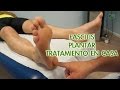 Facitis Plantar Tratamiento para realizar en casa