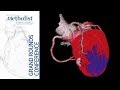 Transforming the Cardiovascular Care Pathway (Matthew Jay Budoff, MD) April 23, 2020