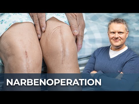 Narbe operativ entfernen lassen - macht das Sinn?
