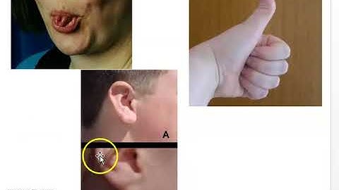 Genetic Diversity and standard deviation