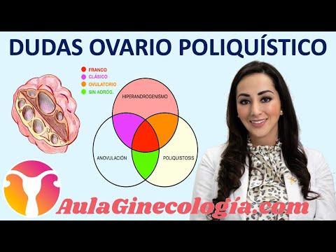 Síndrome ovario poliquístico tratamiento