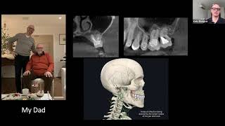 Case Studies of Root Canal Teeth (IABDM Webinar 4/9/2020)
