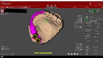 Oneday One case design by R2GATE SA version [8 Oct. 2024]
