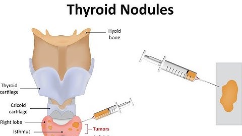 Biopsy Needle CPT code - simplify medical coding