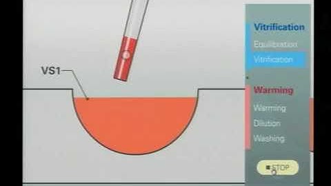 The Cryotech Method of Vitrification by Masa Kuwayama and Goral Gandhi