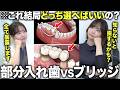 5年後に差が出るのはどっち?ブリッジ vs 入れ歯【歯医者が解説】
