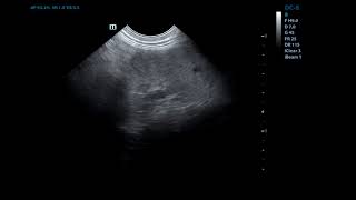 дивертикул кишки у собак bowel diverticula in dogs дивертикул кишки у собак bowel diverticula in dogs