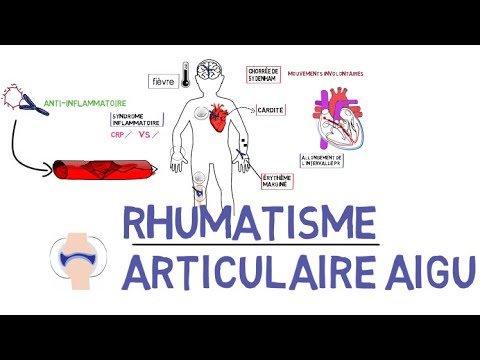 Vidéo: Différence Entre La Fièvre écarlate Et La Fièvre Rhumatismale