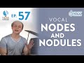 Ep. 57 "Vocal Nodes and Nodules" - Voice Lessons To The World