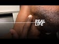 How to make every Ingrown hair go away | Black Men’s Skincare Routine