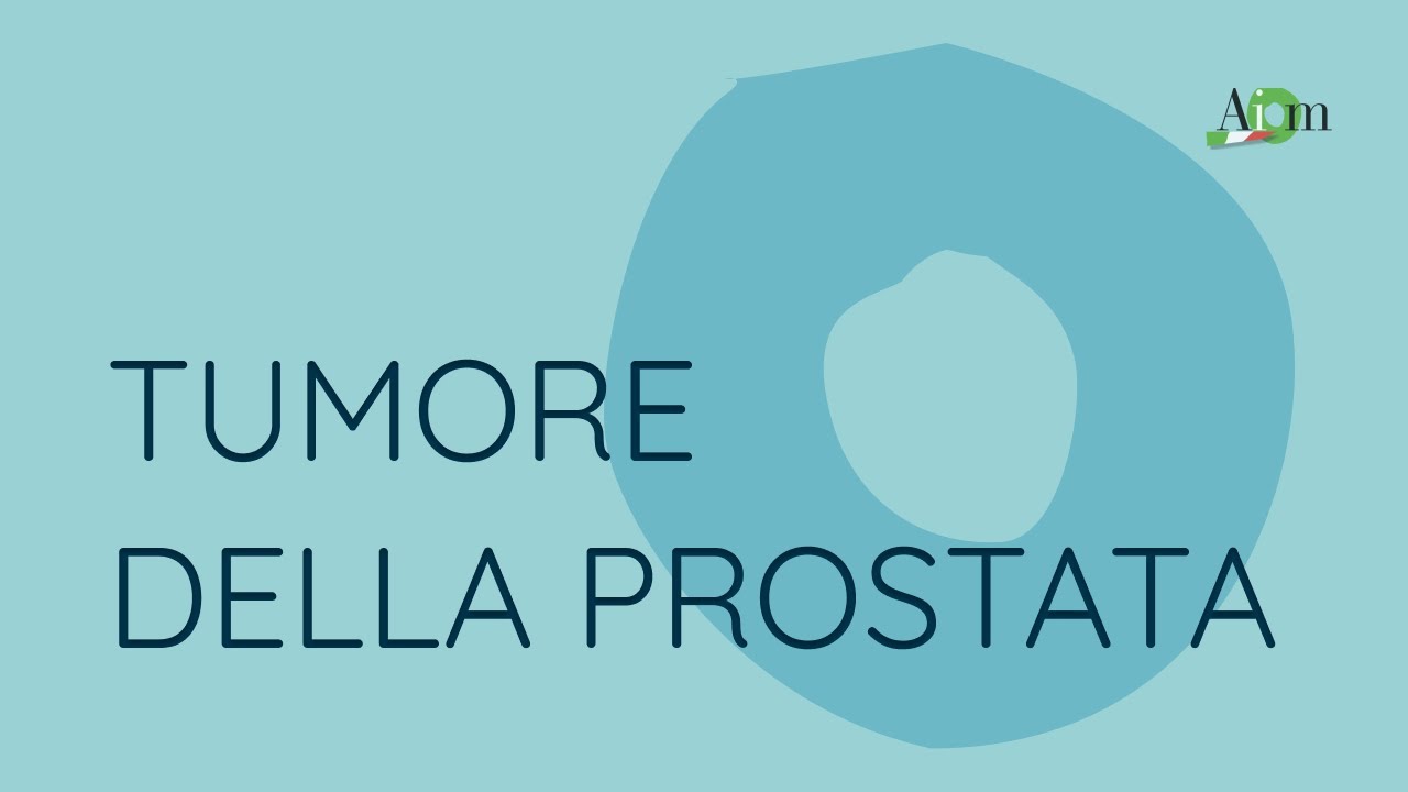 #AIOM21 Talk Show: Prostata, il paziente non metastatico resistente a castrazione