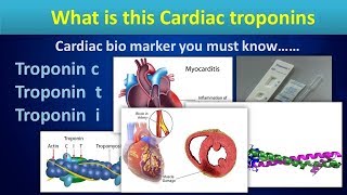 What is this Cardiac troponins.(Cardiac bio markers in Myocardial ischemia)