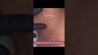 Intimate Bleaching Information