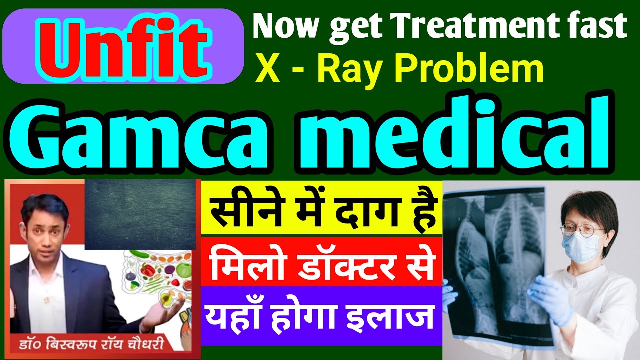 Unfit Gamca medical अब इसतरह से इलाज करा सकते हैं Chest x ray problem