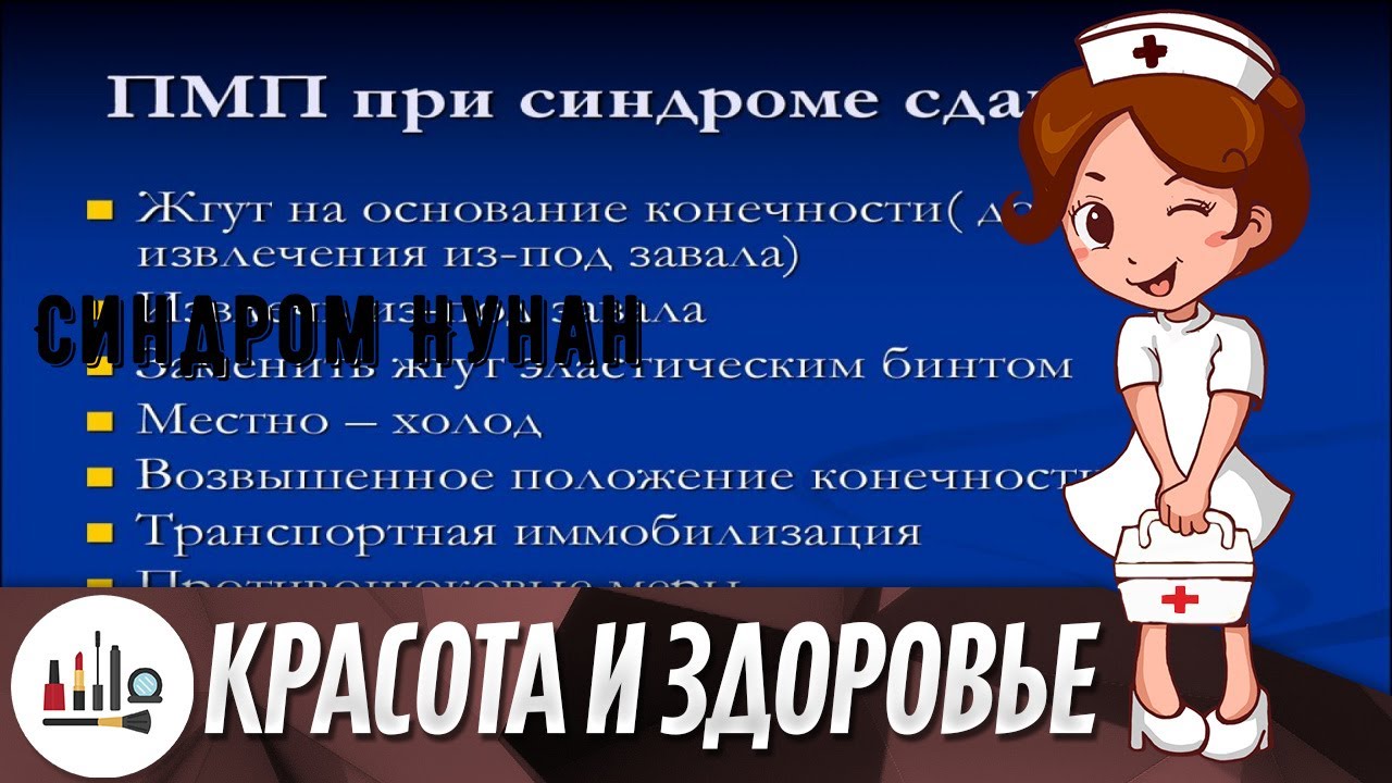 Синдром Нунан