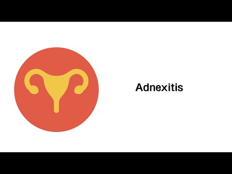 Video: Chronische Adnexitis - Symptome, Behandlung, Exazerbation