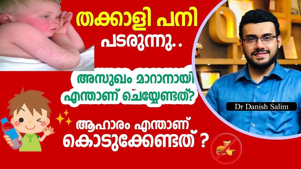 1075:🍅തക്കാളി പനി പടരുന്നു.. അസുഖം മാറാനായി ചെയ്യേണ്ടത്? Hand Foot Mouth Disease | Tomato fever