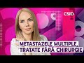 Metastaze în diverse tipuri de cancer- tratamente moderne