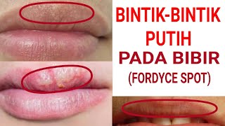 Bintik Bintik Putih Pada Bibir Bagian Atas Youtube