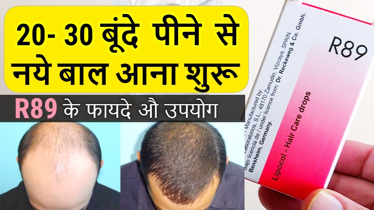 बस 2030 बूंदे पीने से नए बाल आना शुरू R89 medicine for Hair Fall 