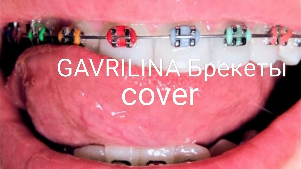 текст песни брекеты юля гаврилина