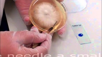 Microbiology: Lactophenol Cotton Blue Technique